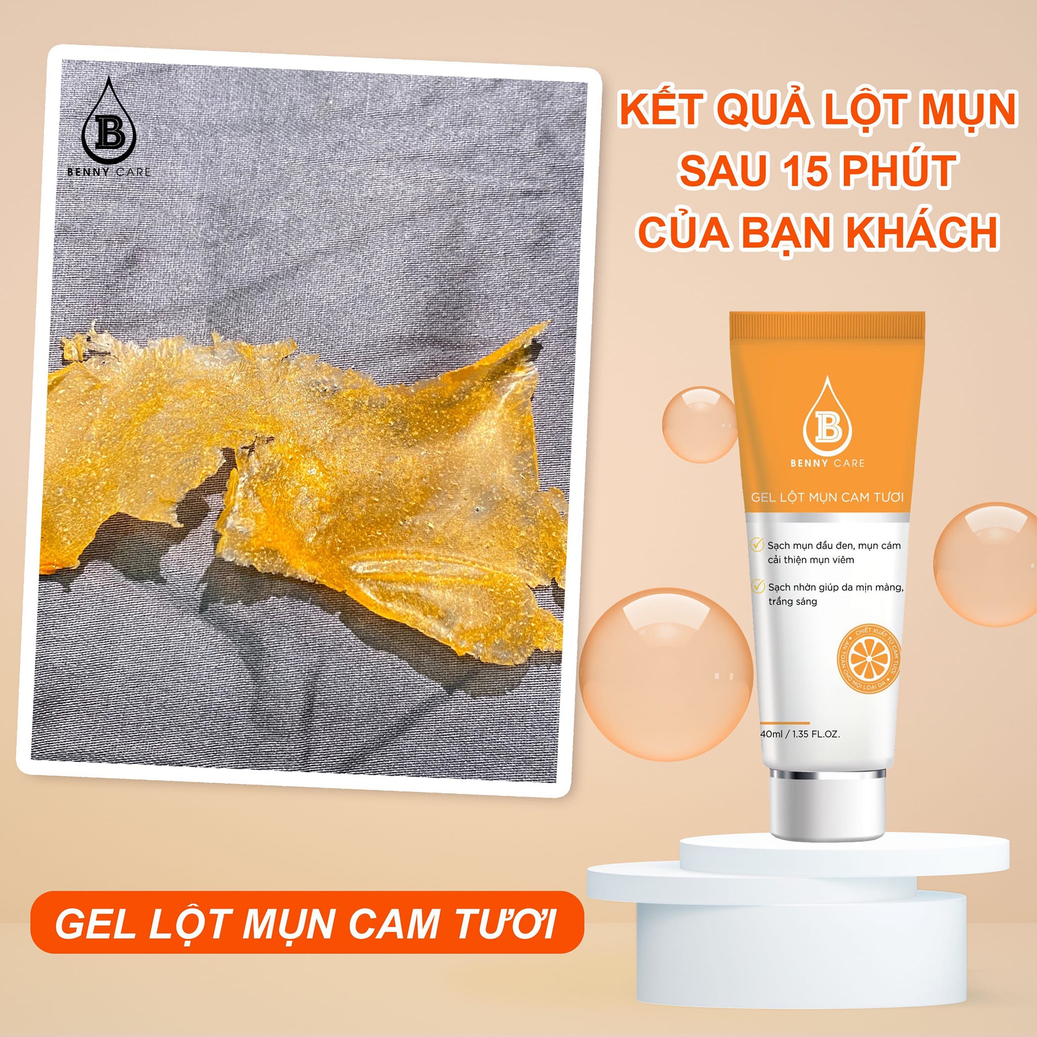Gel Lột Mụn Cam Tươi MD Beauty Benny Care Gel Lột Mụn Cam Tươi MD Beauty Benny Care