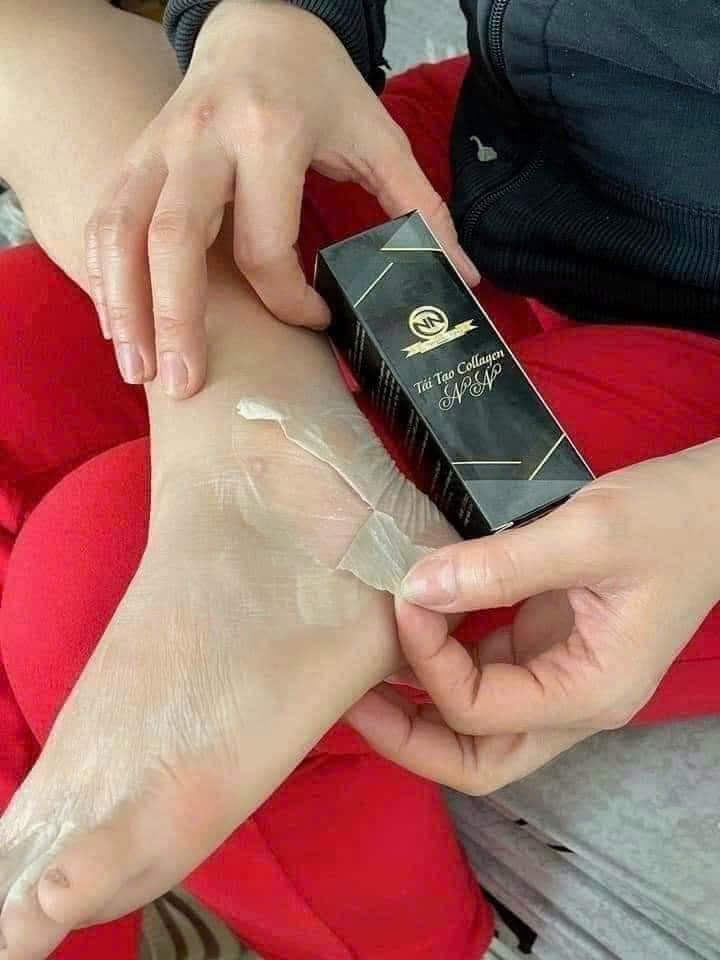 Lôt NN lột luôn cả vùng sẹo thâm luôn nha quý vị ơi Hàng Chính Hãng 100% Lôt NN lột luôn cả vùng sẹo thâm luôn nha quý vị ơi Hàng Chính Hãng 100%