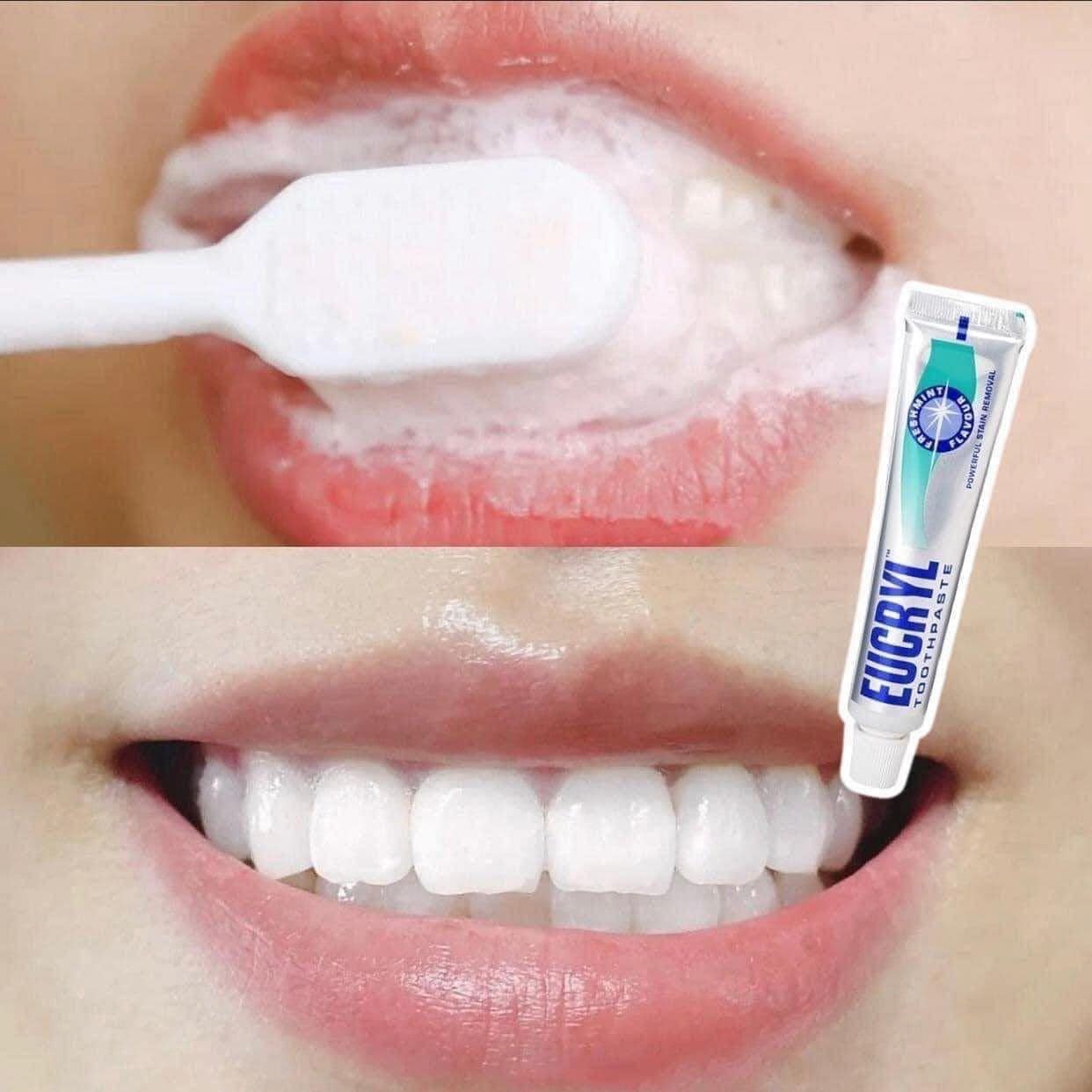 Kem Đánh Răng Giảm Hôi Miệng Eucryl Toothpaste 50ml Của Anh Kem Đánh Răng Giảm Hôi Miệng Eucryl Toothpaste 50ml Của Anh