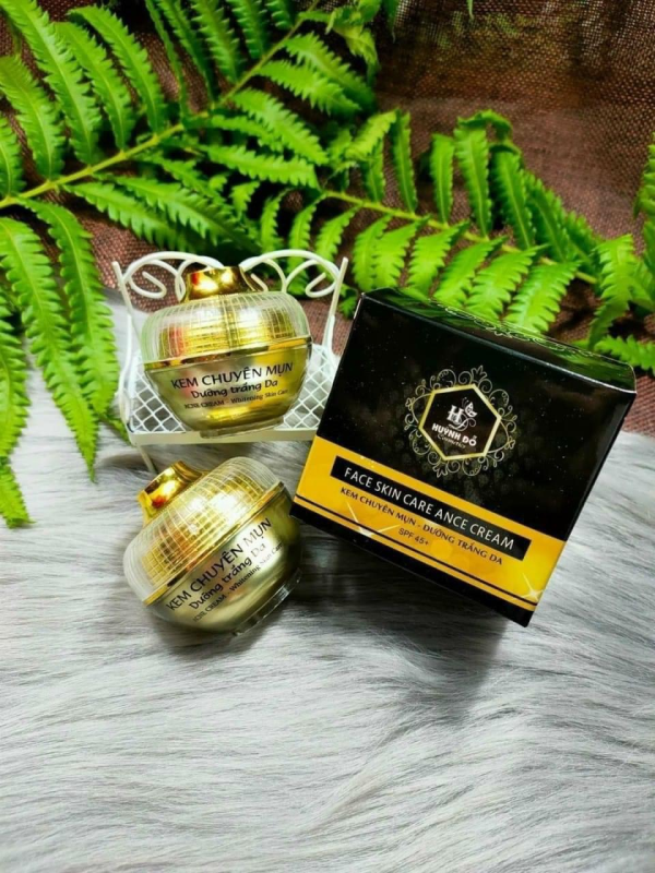 Mụn thường xuyên tái lại Là tại bạn chưa biết đến Kem Face chuyên mụn trắng da Mụn thường xuyên tái lại Là tại bạn chưa biết đến Kem Face chuyên mụn trắng da