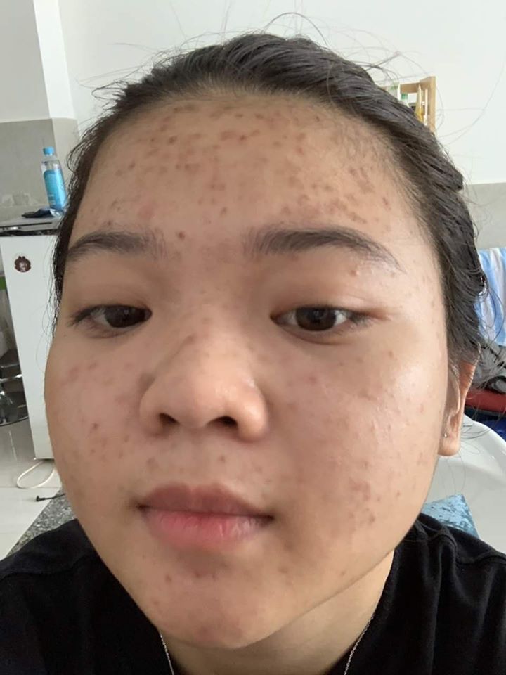 Muốn da đẹp thì phải chăm sài Dr Mai