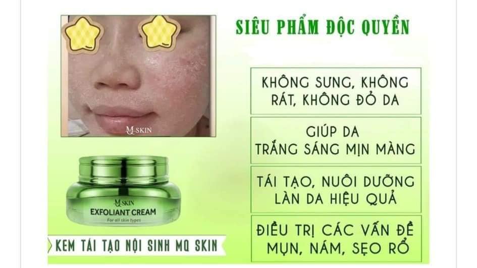 Kem Face Tái Tạo Nội Sinh Exfoliant Cream MQ Skin Tặng Kem Dưỡng HA Kem Face Tái Tạo Nội Sinh Exfoliant Cream MQ Skin Tặng Kem Dưỡng HA