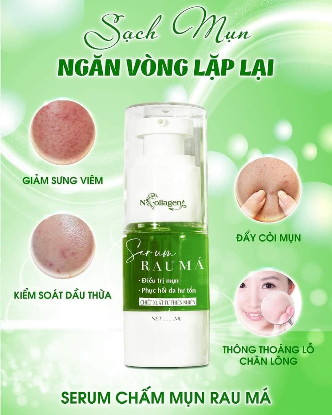 Hết mụn hết tự ti vẹn cả đôi đường Hết mụn hết tự ti vẹn cả đôi đường