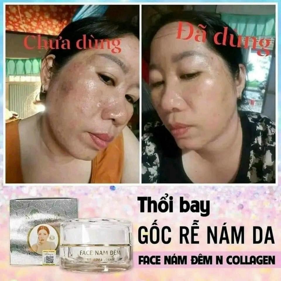 Chỉ với 1 lớp kem Face Nám Đem mỏng mịn trước khi đi ngủ là nàng có thể an tâm tìm lại làn da thanh xuân ngày nào Chỉ với 1 lớp kem Face Nám Đem mỏng mịn trước khi đi ngủ là nàng có thể an tâm tìm lại làn da thanh xuân ngày nào