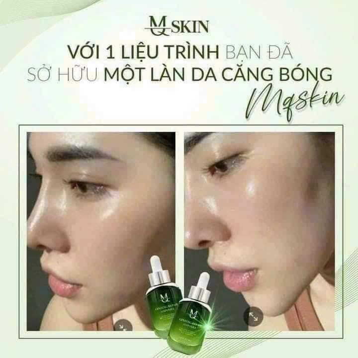 Phù phép làn da căng mịn chuẩn Hàn Quốc với Serum Căng Bóng Da MQ Skin Phù phép làn da căng mịn chuẩn Hàn Quốc với Serum Căng Bóng Da MQ Skin