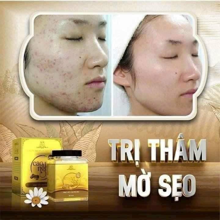 Cao Nghệ Collagen X3 Mỹ Phẩm Đông Anh Cao Nghệ Collagen X3 Mỹ Phẩm Đông Anh