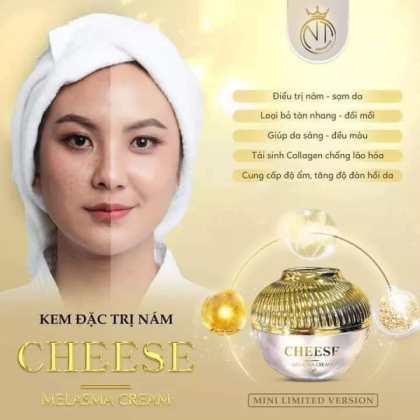 Da đẹp đón Tết xinh cùng Kem Face Nám Melasma Cheese NT Cosmetics Da đẹp đón Tết xinh cùng Kem Face Nám Melasma Cheese NT Cosmetics