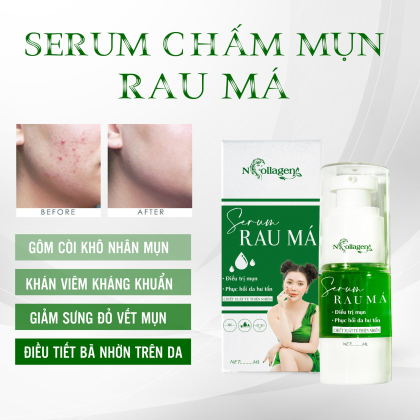 Serum Chấm Mụn Rau Má N Collagen Serum Chấm Mụn Rau Má N Collagen