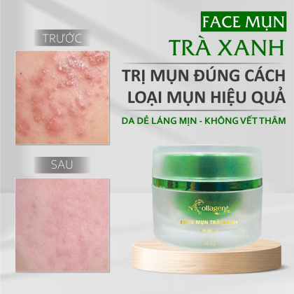 Kem Face Giảm Mụn Tinh Chất Trà Xanh N Collagen Kem Face Giảm Mụn Tinh Chất Trà Xanh N Collagen