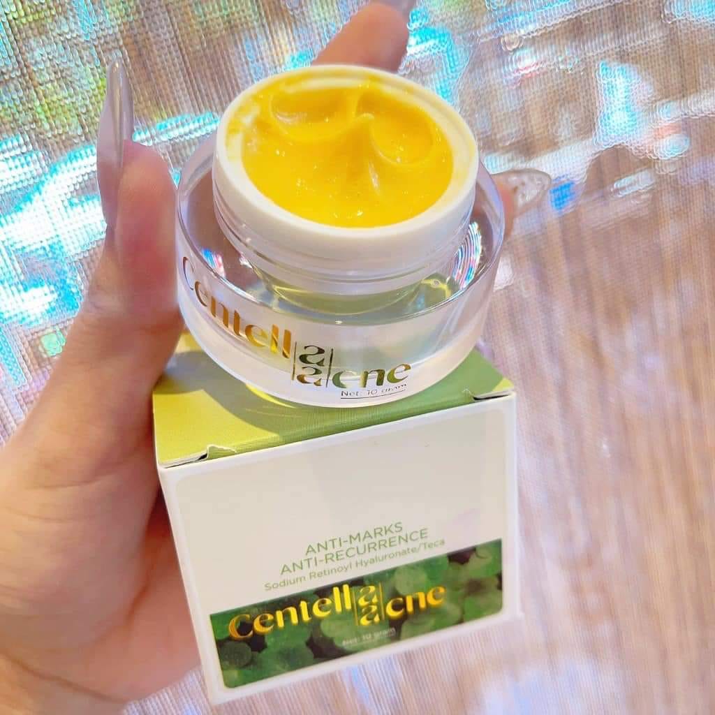 Kem Face Rau Má Thanh Tô Giảm Mụn Jiuhe Centella Acne Kem Face Rau Má Thanh Tô Giảm Mụn Jiuhe Centella Acne