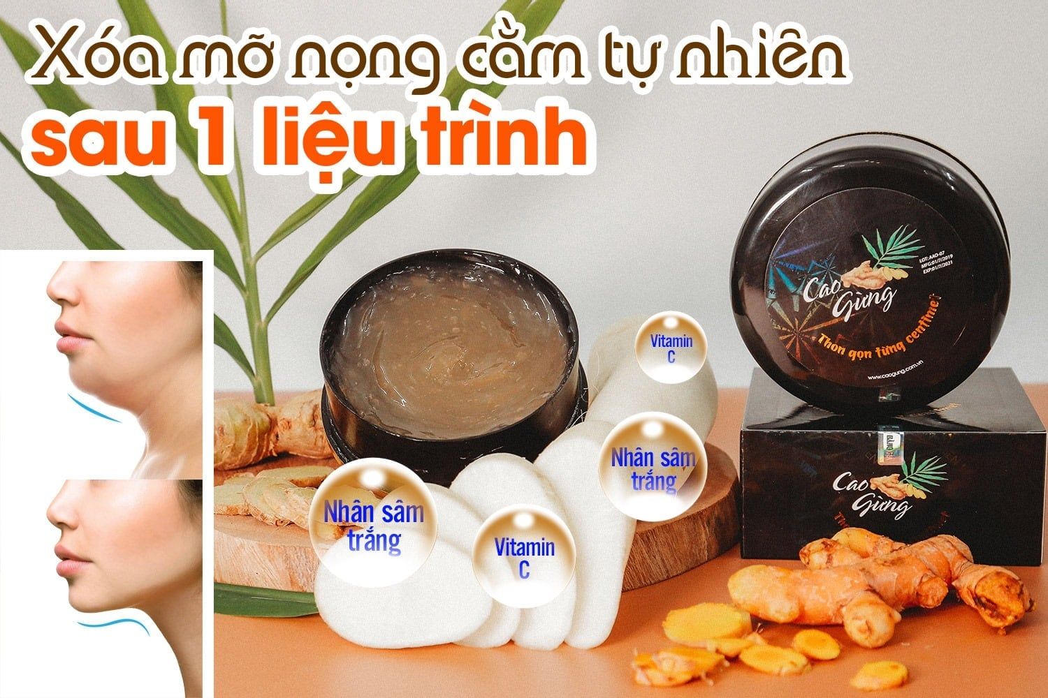 Xóa nọng cằm, thon gọn mặt - chỉ sau 1 liệu trình với Cao gừng