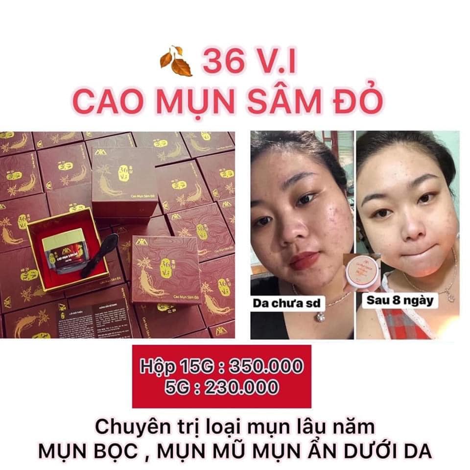 Cao Mụn Sâm Đỏ 36 Vị Thuốc Bắc - Vua Trị Mụn
